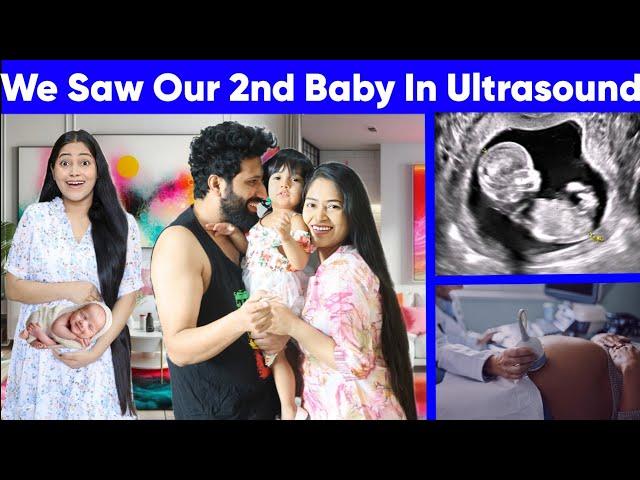 Finally 2nd Baby ka Face Reveal  Baby Ka Face Papa Par Gya 1st time ultrasound mai Baby ko Dekha 🫣