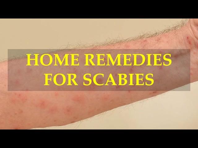 HOME REMEDIES FOR SCABIES