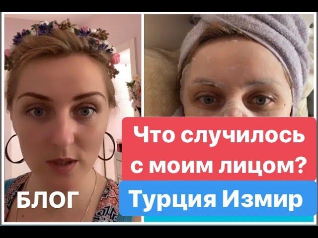 Уход за лицом. Когда начинать? Турция Измир.