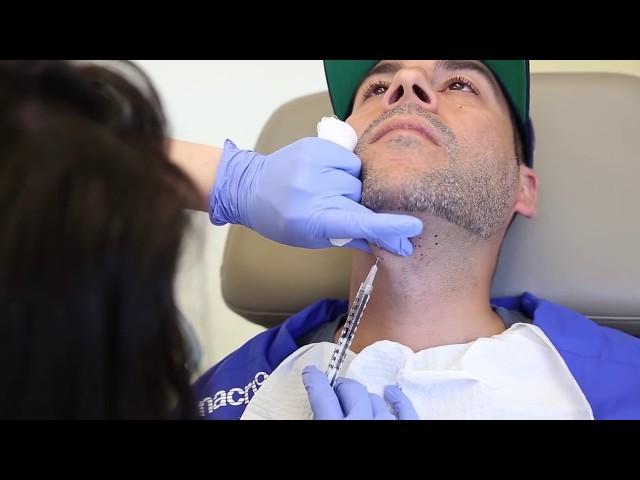 Nik (The Dirty) Gets Kybella at CosmetiCare