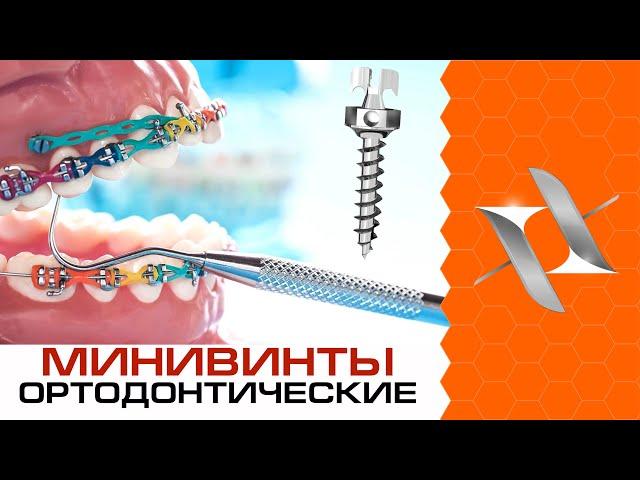 ALL about orthodontic MINI-SCREWS and braces