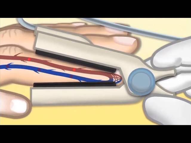 Pulse Oximetry by T. Wolbrink | OPENPediatrics