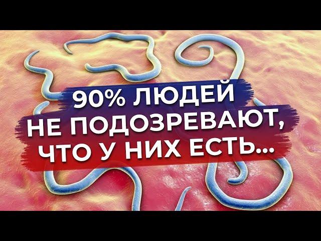 Что такое паразитоз? / Симптомы, лечение и профилактика паразитоза!