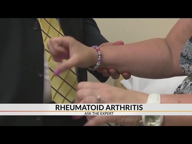 Signs you may have rheumatoid arthritis