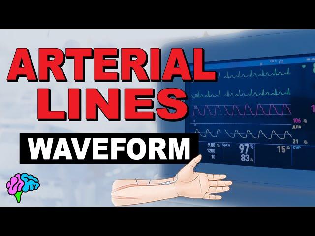 The Arterial Line Waveform EXPLAINED!