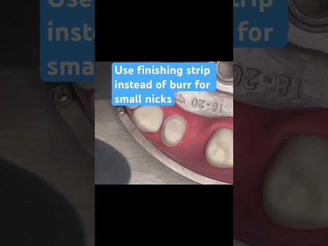 ADEX Exam Prep - Why Finishing Strips Are Safer Than Burrs