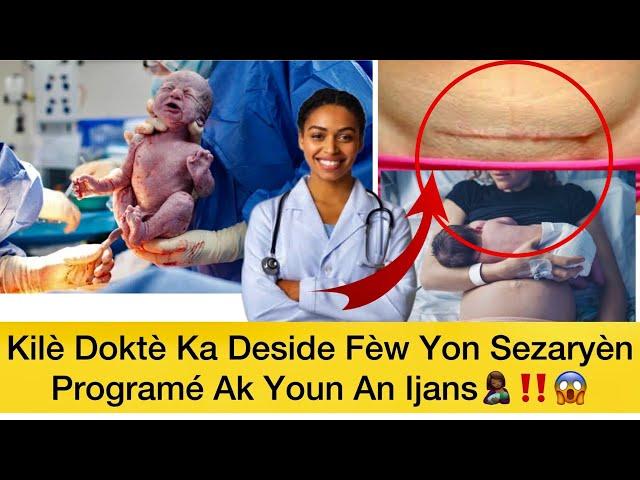 Kilè doktè ka deside fèw yon Sezaryèn Programé ak fèw  Yon Sezaryèn an ijans Gade Video sa‼️