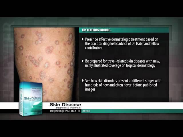 Skin Disease: Diagnosis and Treatment, 3rd Edition