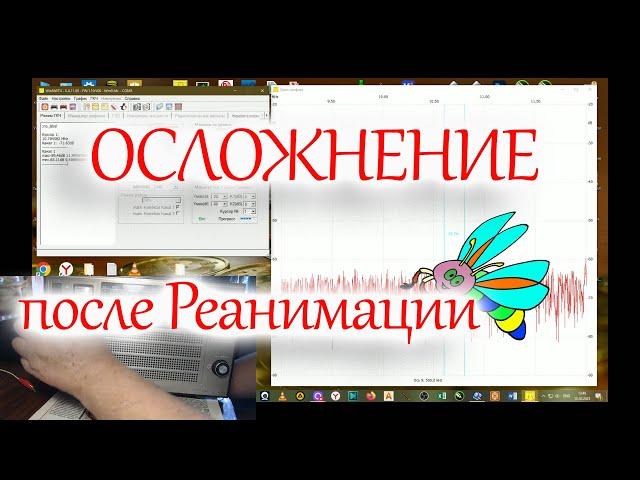 Первые осложнения после ремонта УПЧ ЧМ радиоприемника Океан-214