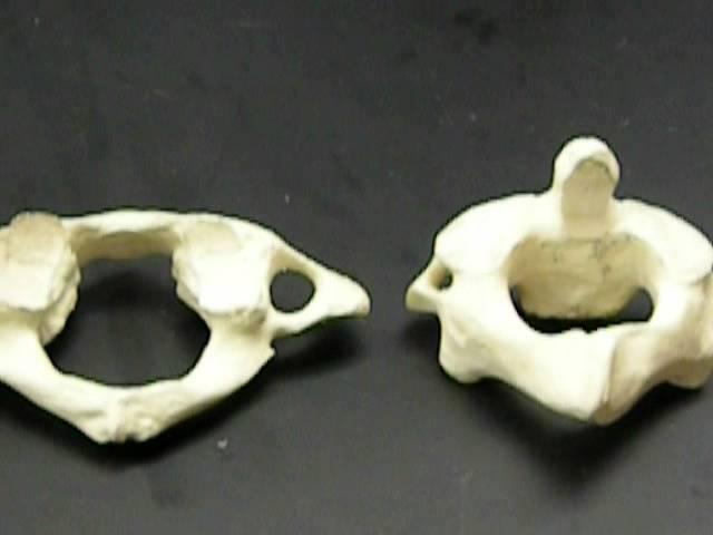 Cervical vertebrae: Atlas & Axis