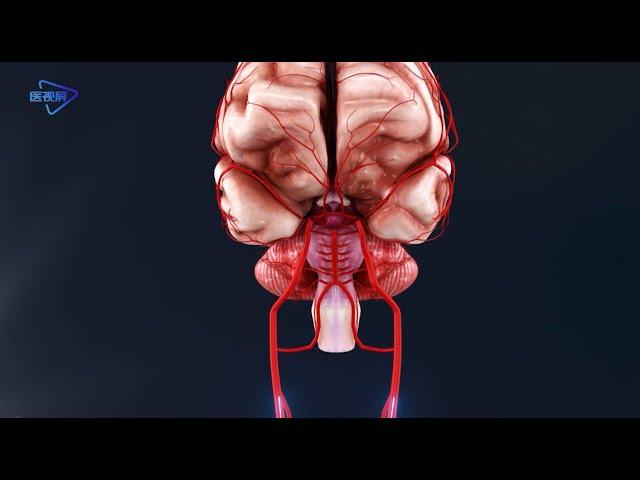 3D 【Human anatomy】-- brain arteries/【人体解剖】--大脑的动脉