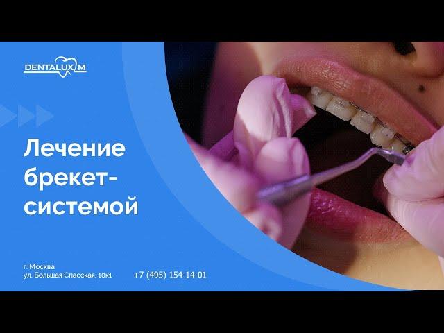  Лечение брекет-системой