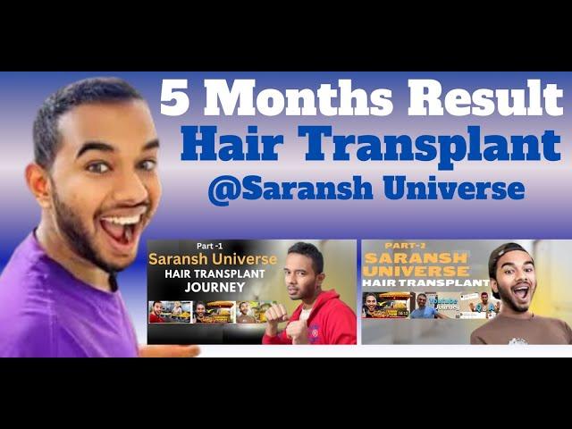 Hair Transplant in indore | Best Results & Cost of Hair Transplant in indore