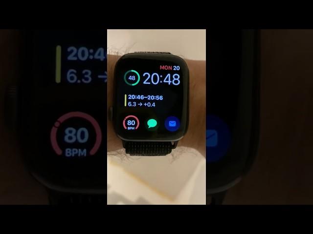 Getting blood glucose with Apple Watch