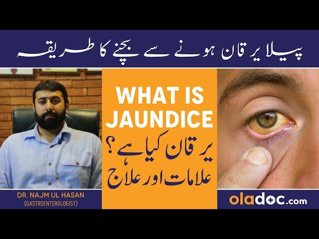 Yarkan Ka Ilaj In Urdu - Jaundice Symptoms Treatment - Peela Yarkan Kyun Hota Hai - Viral Hepatitis