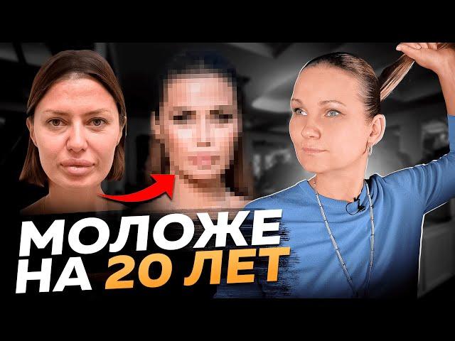 PONYTAIL FACELIFT - ПАЦИЕНТКИ В ВОСТОРГЕ