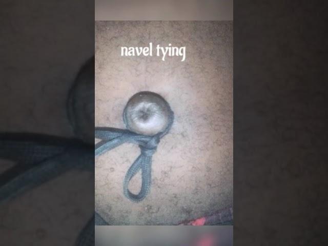 navel torture