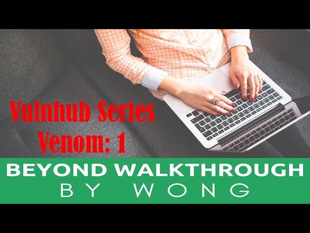 Cyber Security | Ethical Hacking | Pentesting Lab | Vulnhub | Walkthrough | Venom