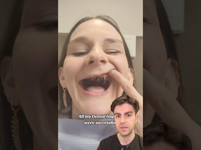 Replacing ALL Teeth With Implants