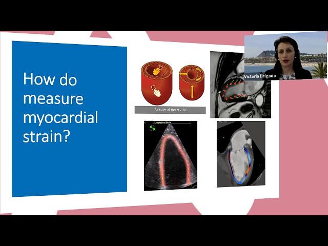 Introduction Strain Symposium by Dr. Victoria Delgado - EACVI