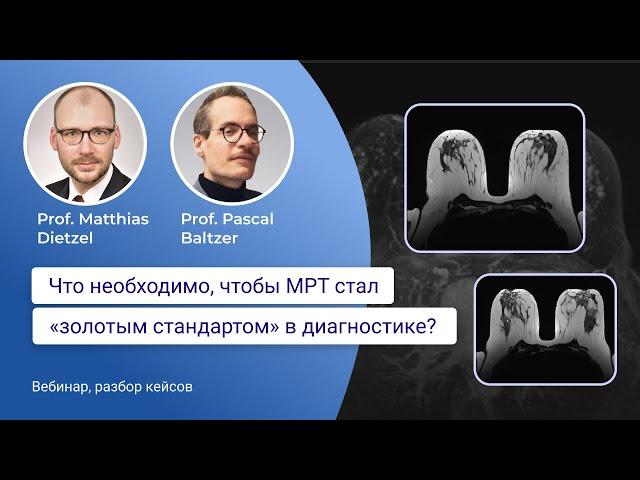 Вебинар "Что необходимо, чтобы МРТ стал «золотым стандартом» в диагностике?"