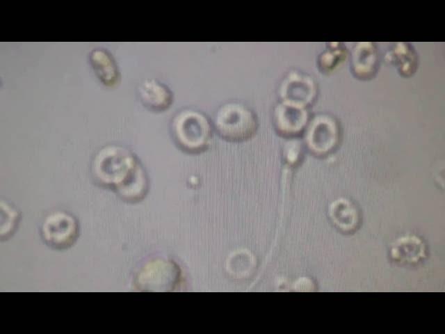 КРОВЬ И СПЕРМАТОЗОИДЫ в МОЧЕ под микроскопом!!! BLOOD And SPERMATOZOA in URINE under a microscope!!!