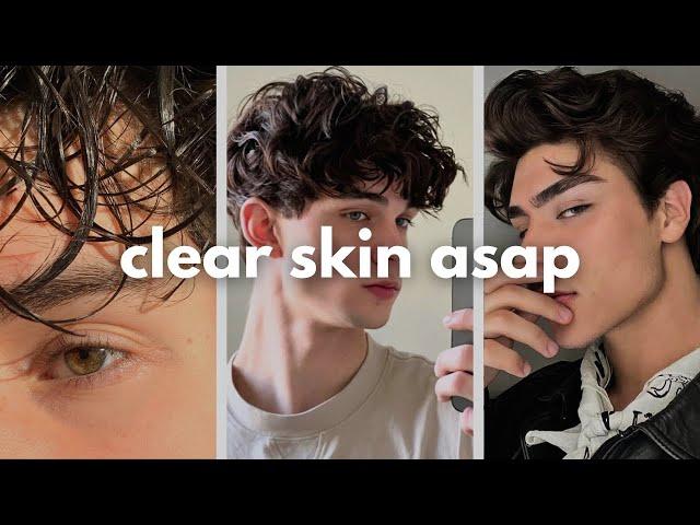 how to get clear skin for guys asap (no bs guide)