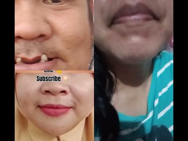 #tiktok #trend#collab #funny 