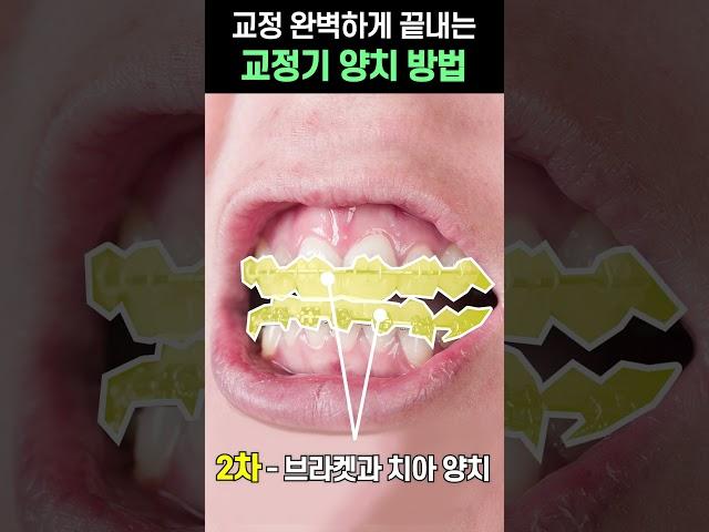 치아교정 완벽하게 해내는 교정 양치 방법! #shorts