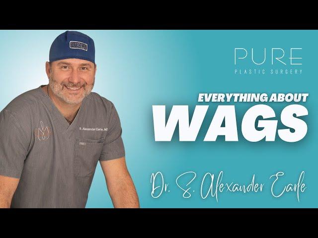 Everything about WAGS