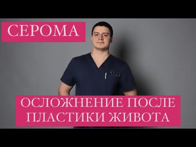 Осложнение после пластики живота - серома Абдоминопластика Диастаз Пластика Пластический хирург