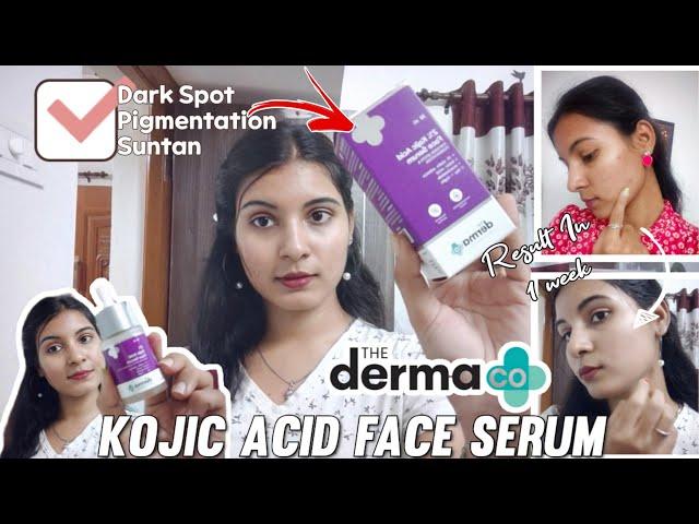 DARKSPOT PIGMENTATION SUNTAN "the Dermco Kojic Acid Serum" Does It Really Works ?