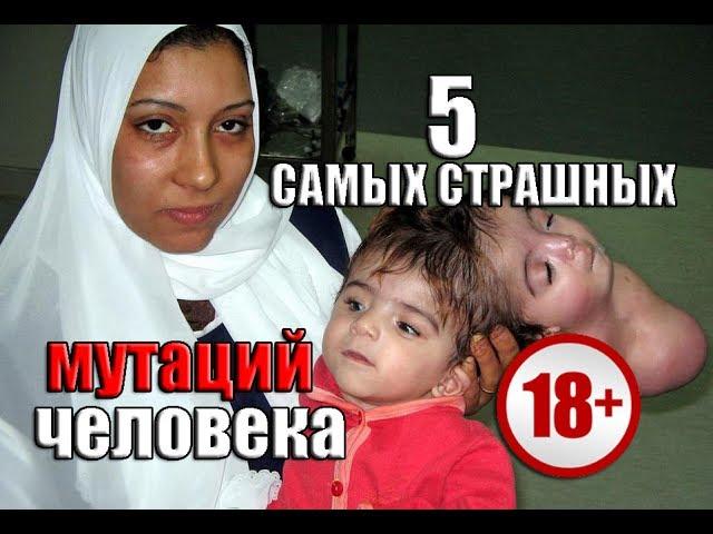 5 САМЫХ СТРАШНЫХ мутаций человека