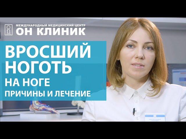 Вросший ноготь на ноге. Причины и лечение вросшего ногтя без хирурга