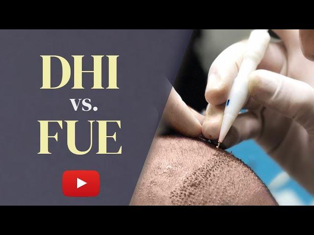 DHI vs FUE Hair Transplant: Which is the BEST Choice in 2023?