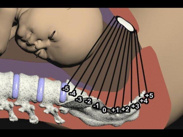 Seven Cardinal Movements of Labor by Cal Shipley, M.D.