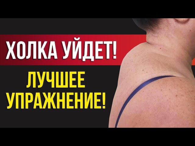 Как убрать холку на шее за 3 минуты! / 5 упражнений  от «вдовьего горба»