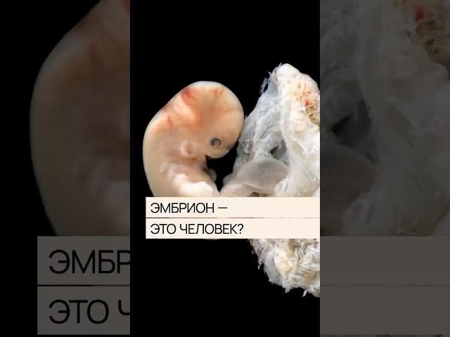 Эмбрион — это человек?