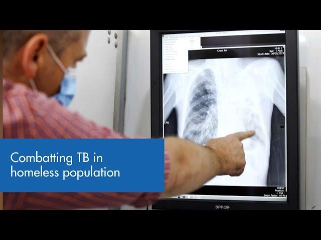 Battling tuberculosis in the time of COVID-19