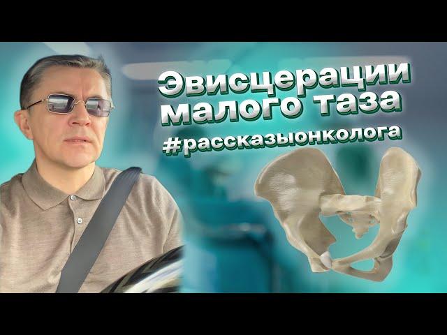 Эвисцерации. Масштабные операции на органах малого таза. Онкология