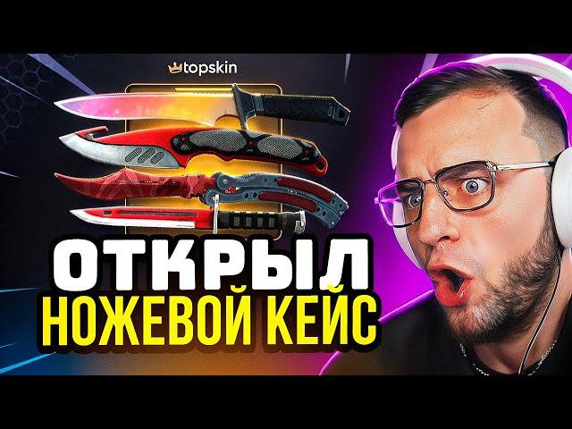 Сколько Ножей Выпдает в КС ГО ? Ножевой Кейс в CS GO - Это Надо Видеть... Topskin Промокод