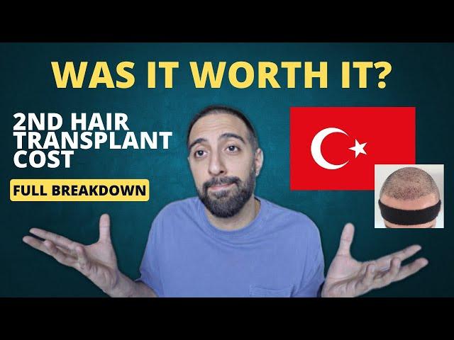 FULL COST of a 2nd Hair Transplant from Turkey