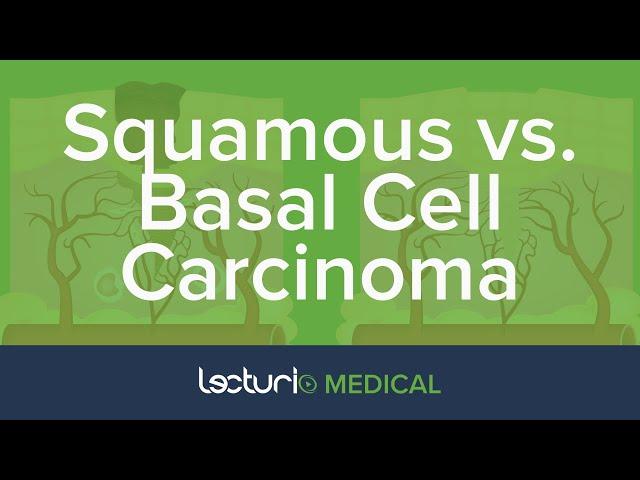 Squamous Cell Carcinoma (SCC) vs. Basal Cell Carcinoma (BCC) | Dermatology