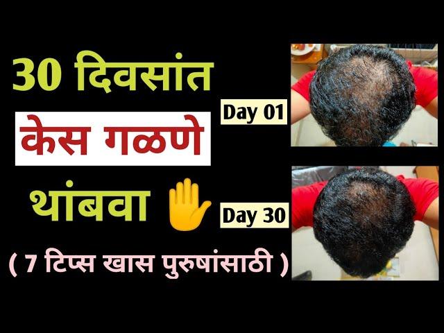 ३० दिवसात केस गळणे थांबवा (७ टिप्स खास पुरुषांसाठी )/ केस गळतीवर उपाय | SACHIN SAMEL