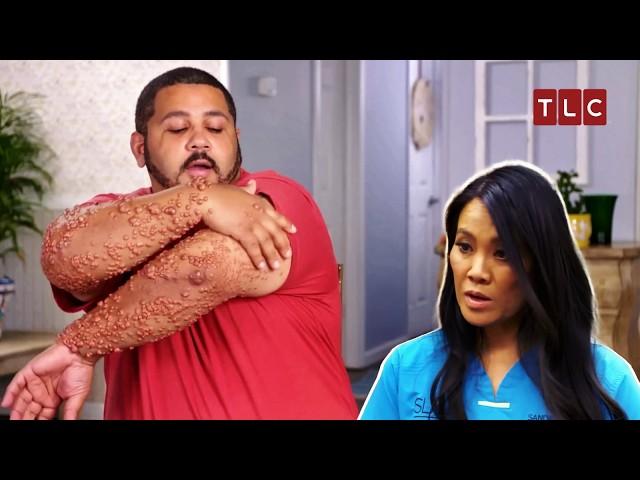 The Strangest Case of Dr Lee’s Career! | Dr Pimple Popper TLC