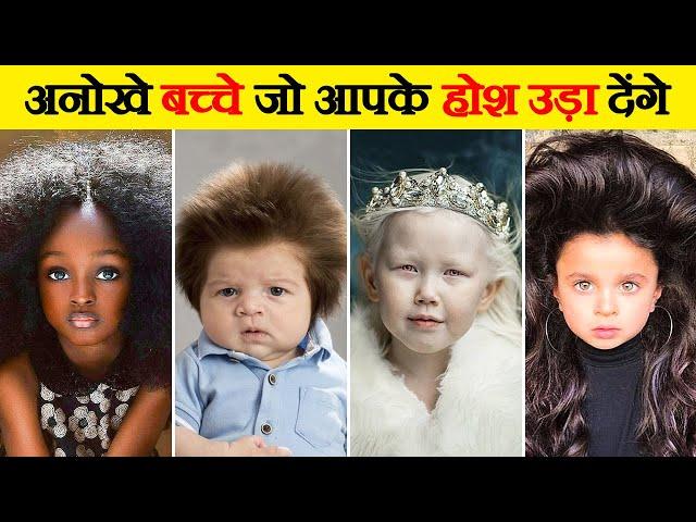 लाखो में एक है ये अनोखे बच्चे | 10 Most UNUSUAL Kids In The World | Kids You Won't Believe Exist