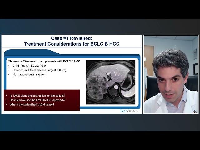 The Collaborative Benchmark for HCC: Critical Discussions Between IR–Oncology Professionals