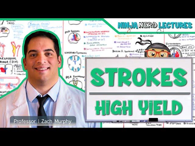 Ischemic and Hemorrhagic Strokes | High Yield