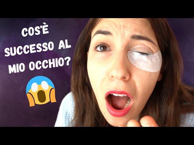 COS'E' SUCCESSO AL MIO OCCHIO?? Laminazione ciglia finita male?