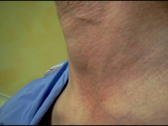 my neck - adams apple swallow 2
